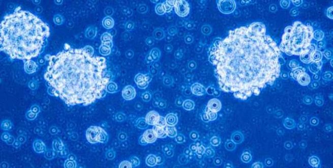 Klīnikas “iVF Riga” Cilmes šūnu centrs ieguvis farmaceitiskās darbības licenci šūnu terapijas produktu ražošanai