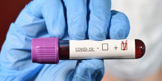 EK neiesaka lietot aptiekās pieejamos ātros paškontroles Covid-19 testus