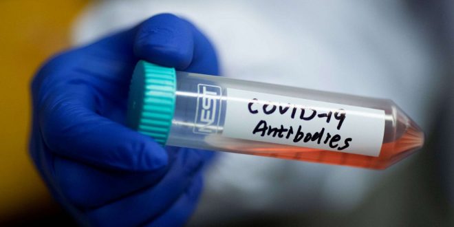 Latvijā reģistrēti 2628 jauni Covid-19 inficētie; 12 miruši, 10 no tiem nebija vakcinēti