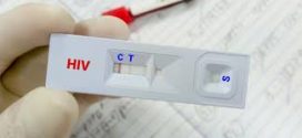 Bezmaksas, anonīmi un bez nosūtījuma — visā Latvijā notiek HIV un hepatīta testēšanas nedēļa