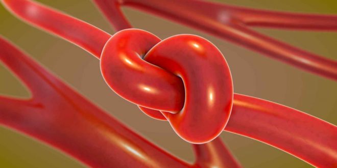 24. septembris – Starptautiskā Ģimenes hiperholesterinēmijas diena Latvijas Ģimenes hiperholesterinēmijas reģistram – 10 gadi!